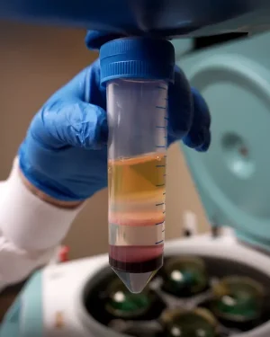 PBMC Isolation & Cryopreservation